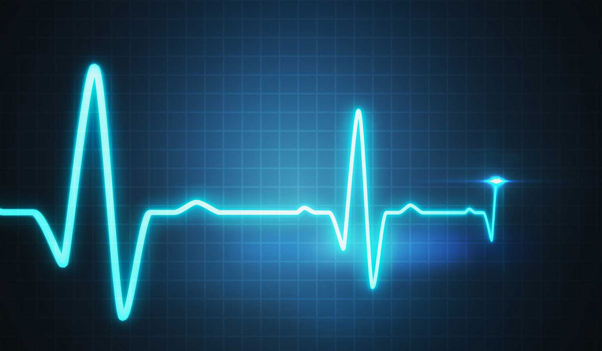 ECG monitoring heart rate